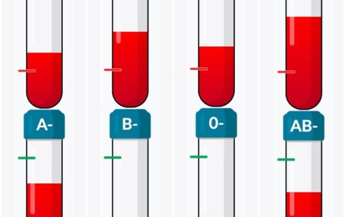 Nedostaju zalihe pojedinih krvnih grupa, odazovite se akcijama darivanja krvi!